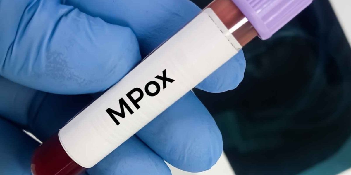 Mpox Au Maroc Aucun Cas Na été Détecté Depuis Des Mois Ministère